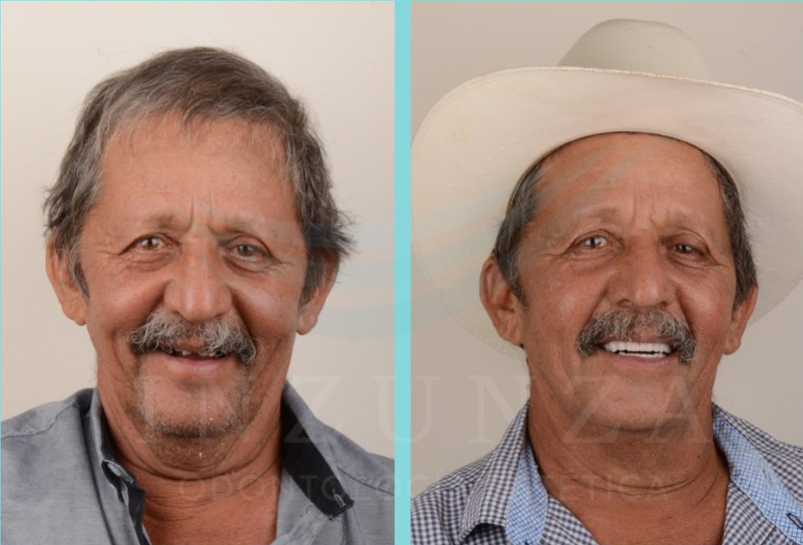 Rehabilitación Oral en Culiacán